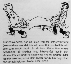 Hanås - pump och risk för ketoacidos